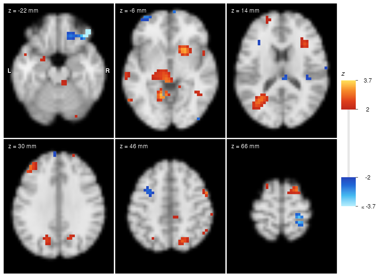 Six axial slices of the template with a thresholded simulated z map: positive values in red-yellow, negative in blue