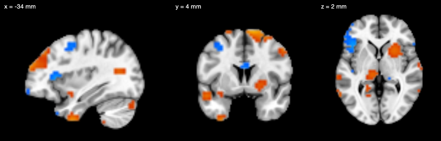 Sagittal, coronal and axial views of the MNI152 template with a thresholded simulated statistic map: positive values in red-orange, negative in blue