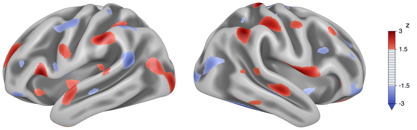 Lateral views of the left and right inflated hemispheres with a simulated z map thresholded at 1.5 in absolute value, and a colour key from -3 to 3 with the interval from -1.5 to 1.5 hatched